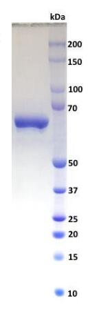 HSA was loaded and resolved on 8-22 % SDS-PAGE and stained with Coomassie G-250.